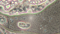 Ciliates trapped